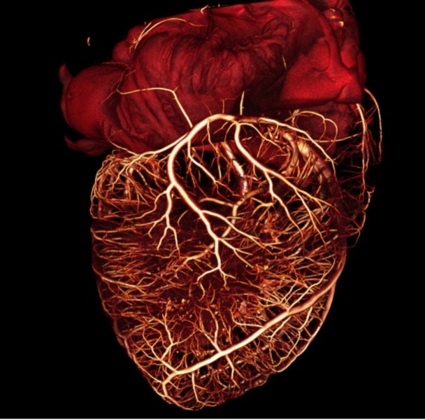 A visualization of the heart's circulatory system, generated from micro-computed tomography. Image: Mark L. Riccio/Cornell University µCT Facility for Imaging and Preclinical Research and Flavio H. Fenton/Cornell University